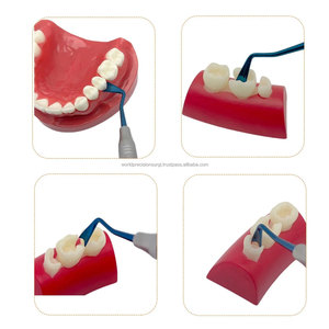 Ensemble de rétracteurs gingivaux pour implants dentaires de précision mondiale, 3 pièces, 4,5/5,5/6 mm, séparateur de gencives en acier inoxydable chirurgical - Product Image 3