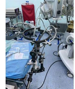 Instruments Neurochirurgicaux Système d'Écartement Cérébral Écarteur Cérébral - Product Image 4