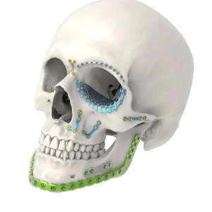 Juego de Instrumentos Reutilizables de Cirugía Plástica Maxilofacial de Acero Inoxidable, Manual, para Uso Hospitalario, Cirugía Abdominal, por Dentavex - Product Image 3