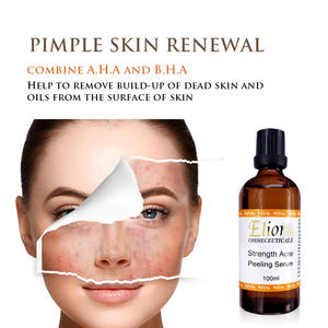 Cuidado de la Piel para Piel Propensa al Acné, Exfoliante para Puntos Negros, Gel Exfoliante con 10% de Ácido de Almendras y Ácido Salicílico, con Efecto Blanqueador para el Rostro - Product Image 2