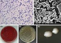 Poudre blanche probiotique IGC Brand Lacticaseibacillus Paracasei pour le soutien immunitaire, 5 à 100 milliards d'UFC/g, fabriquée dans le Maharashtra