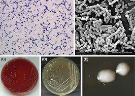โปรไบโอติก IGC แบรนด์ แลคติคาไซบาซิลลัส พาราเคเซย์ ผงสีขาว เสริมภูมิคุ้มกัน 5-100 พันล้าน CFU/กรัม ผลิตในมณฑลมหาราษฏรา - Product Image 3