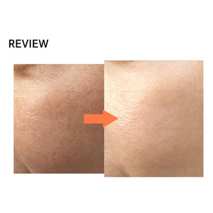 Suero Facial Coreano Aclarante con PDRN, Antiarrugas, Colágeno, Hidratante, Ampolla Facial de 70 ml para Rostro y Cuello, Uso Diario - Product Image 3