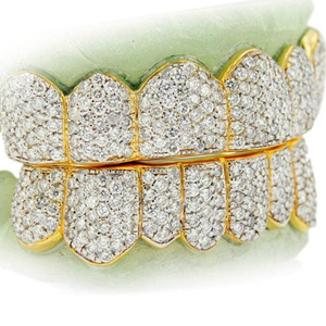 Grillz dentaire Hip Hop personnalisé en argent sterling 925 avec moissanite taille brillant certifiée IGI, 14 dents serties en canal, unisexe, 7 supérieures 7 inférieures - Product Image 6