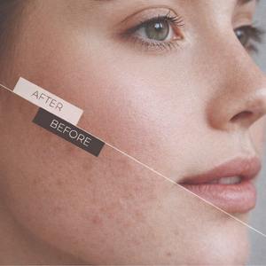 Jabón Artesanal 100% Natural, Orgánico, Puro, a Base de Hierbas, en Forma de Oso de Peluche, Jabón en Barra para Blanquear la Piel, Hidratante, Jabón de Baño para Niños, Regalos - Product Image 6