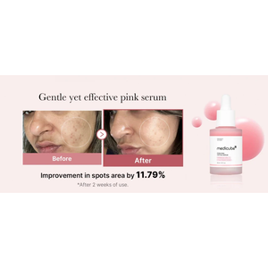 Siero Viso PDRN, Essenza PDRN, Formula Leggera, Siero per Imperfezioni, Siero con Vitamine, Fiala Idratante - Product Image 6