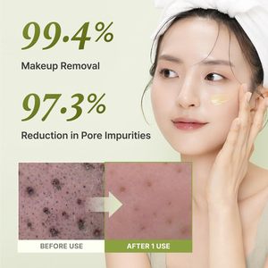 Bálsamo Limpiador de Té Verde YADAH 100ml, Desmaquillante, Limpiador Facial, Fórmula Sorbet-to-oil-to-milk, Oliva, Girasol, Jojoba - Product Image 4