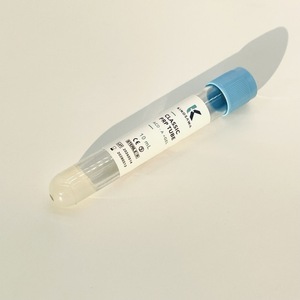 หลอด PRP (Platelet Rich Plasma) สำหรับการดูแลความงาม การรักษาด้านความงาม และการฟื้นฟูเส้นผม - Product Image 6