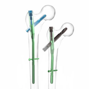 Implantes Ortopédicos de Calidad Superior para Cirugía Básica, Juego de Placas Óseas para Animales Pequeños, Instrumentos Quirúrgicos Veterinarios de Acero Inoxidable - Product Image 5