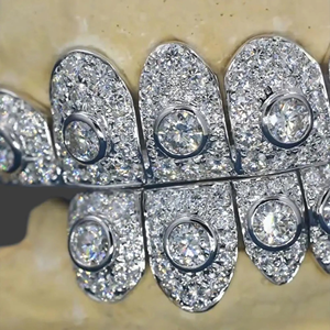 Grillz dentaire Hip Hop personnalisé en argent 925 plaqué or, serti de moissanite, bijoux de corps de luxe - Product Image 4