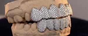 Grillz dentaire diamanté en promotion : Bijou de luxe étincelant pour le style, les fêtes, les événements et les occasions spéciales - Product Image 3