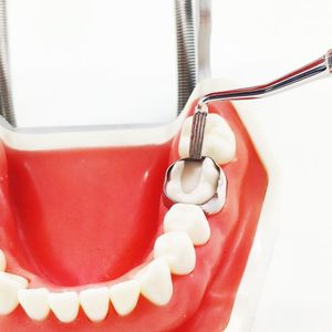 Poussoir et poseur de bandes orthodontiques professionnel à double extrémité avec détartreur |   Bande moléculaire à pointe longue en acier inoxydable de qualité supérieure - Product Image 4