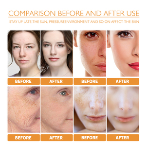 Suero Facial de Niacinamida y Vitamina C de 30 ml, Blanqueador, Hidratante, Esencia para el Cuidado de la Piel con Vitamina C - Product Image 3