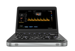 Système d'échographie approuvé <span class=keywords><strong>CE</strong></span>, écran LCD numérique portable de 12 pouces, appareil d'échographie vétérinaire - Product Image 2