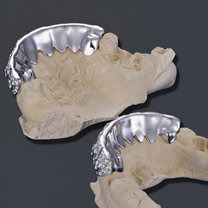Grillz de Dientes Unisex de Plata 925 Estilo Hip Hop, Dientes Personalizados con Diamantes de Moissanita y Cadena de Oro Blanco, Joyería al Mejor Precio - Product Image 5
