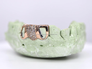 Customize Hip Hop Iced Out Teeth Popular Grillz 8 on 8 Top Bottom Moissanite Diamond Custom New Fashion Grillz for Unisex - Product Image 2