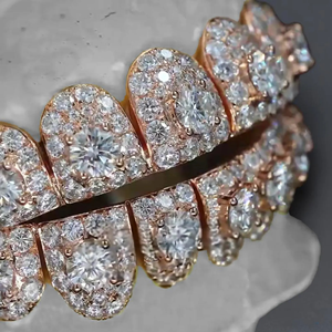 Grillz de Dientes Personalizados de Plata 925 con Incrustaciones de Diamantes Moissanite, Estilo Hip Hop, Joyería de Plata, Mejor Precio - Product Image 2