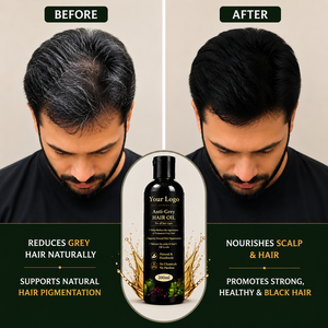 Aceite Anticanas de Marca Privada para la Canedad Prematura, Pigmentación Natural del Cabello y Cuidado del Cuero Cabelludo |   Aceite Capilar Herbal - Product Image 1