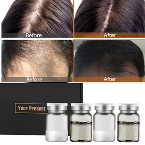 Suero para el Crecimiento del Cabello Más Vendido, Tónicos para el Crecimiento del Cabello, Tratamiento Revitalizante del Cuero Cabelludo, Líquido Anticaída - Product Image 1