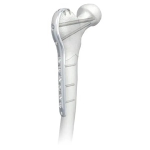 Placa femoral lateral proximal de trocantero ICP profesional personalizada, placa de bloqueo de titanio, manual, certificada ISO13485 - Product Image 3