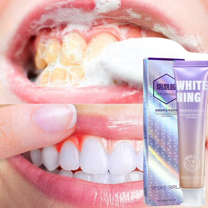Индивидуальный Логотип, 100 г, никотинамид, отбеливающая зубная паста, отбеливание зубов, очистка, отбеливание, удаление пятен, зубная паста