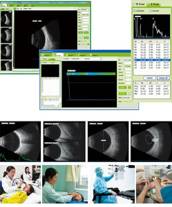 Escáner Oftálmico A/B de Bajo <span class=keywords><strong>Precio</strong></span> en China para Examen Oftalmológico y Prueba de Biometría Ocular en Oftalmología - Product Image 6
