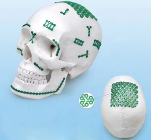 Kit de micro-plaques maxillo-faciales en forme de DF pour implants orthopédiques, soins manuels ORL - Product Image 4