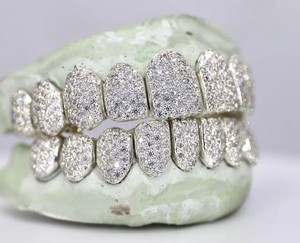 Grillz en argent sterling 925 sertis de moissanite, ajustement personnalisé, bijoux dentaires pour hommes et femmes, accessoire de mode - Product Image 2