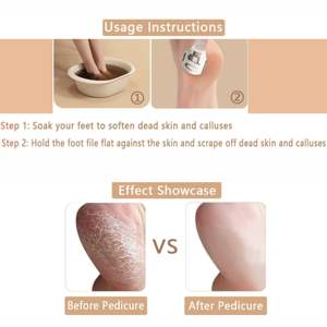 Lima profesional para pies, removedor de callos de acero inoxidable, raspador para talones agrietados y piel seca, borde afilado duradero - Product Image 4