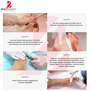 Herramientas Quirúrgicas Reutilizables de Acero Inoxidable 2026 para el Cuidado de los Pies, de Proveedor Confiable, Duraderas, Ligeras, Antideslizantes y Aptas para Autoclave - Product Image 5