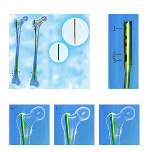 Forceps orthopédiques postérieurs en acier inoxydable de haute qualité, réutilisables, certifiés C-Tick, à stérilisation manuelle à haute température - Product Image 2