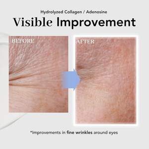 นอวาเตอร์ ทีวัน พรีสทีจ คอลลาเจน อาย ครีม 25 มล. |   ผลิตภัณฑ์บำรุงผิวหน้าสูตรต่อต้านริ้วรอยจากเกาหลี ลดรอยคล้ำ ริ้วรอยเล็กๆ กระชับผิว - Product Image 5