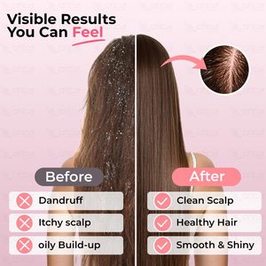 Silicone Scalp Massager Hair <b>Brush</b> Cushion <b>Round</b> Manual Hairbrush Waterproof Cleaning <b>Brush</b> for Home Use - Product Image 5