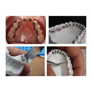 Brackets Linguales Ortodónticos, Sistema de Brackets Invisibles Ocultos, Estética Dental del Lado Interno, Personalizados, Manuales, Certificados CE, Clase I - Product Image 3