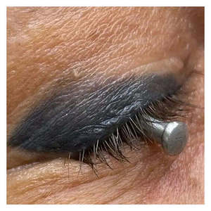 Protège-œil en acier inoxydable |   Protection oculaire laser |   Protecteur corneal - Kit chirurgical personnalisé en acier inoxydable / Ciseaux chirurgicaux - Product Image 5