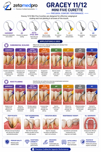 Cureta Dental Gracey 11/12 Mini Five de Alta Precisión, Instrumento Periodontal Estándar y Rígido para Escariado de Bolsillos Profundos OEM Zetomed - Product Image 3