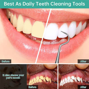 Escaladores Dentales de Alta Calidad Hechos en Pakistán, Fábrica de Escaladores Dentales, Fabricación de Escaladores Dentales - Product Image 6