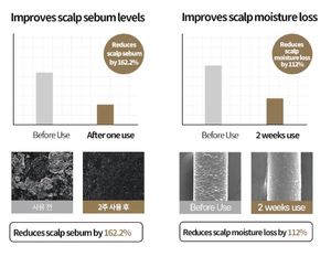 SMiB Natural Scalp Treatment Volumizer <b>Shampoo</b> Anti Hair Loss Oil Control Niacinamide Dexpanthenol Soothing Hydrating Sulfate - Product Image 4