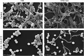 Poudre de probiotiques pure à 100 % de haute qualité IGC Saccharomyces Boulardii pour la prévention de la diarrhée chez les enfants - Product Image 2