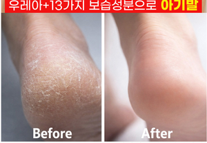 SULSURYUN UREA FOOT STICK 18g Stick pour les pieds à l'urée, adoucissant pour les talons, infusé aux huiles naturelles, cosmétique coréen K-beauty, certifié MSDS, marque originale OBM - Product Image 3