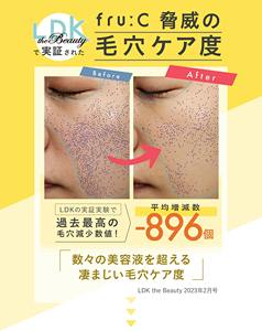 เซรั่มวิตามินซีเข้มข้นสูง 5 คราวน์วินเนอร์ ดูแลรูขุมขน ออลอินวัน จากญี่ปุ่น 28 มล. ผลิตจากผลไม้ VCIP ไฮยาลูรอนิก แอซิด ยี่ห้อ Fru:C - Product Image 4