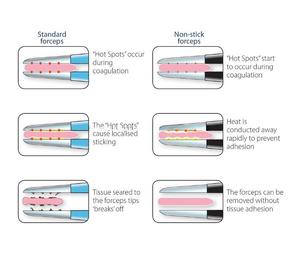 คีมจับไฟฟ้าชนิดโมโนโพลาร์คุณภาพสูง ผลิตจากพลาสติก ทนทานต่อการใช้งานซ้ำ และเหมาะสำหรับการผ่าตัดแบบไฟฟ้า - Product Image 5