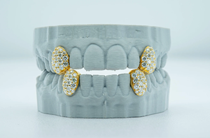 Custom 2 Top 2 Bottom S925 Plata Solid Gold Plated D VVS Moissanite Diamond 100% Passed Diamond Tester Dientes Grillz - Product Image 4