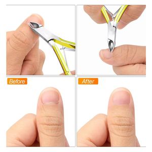 Morje Coupe-cuticules chirurgical à pointe de précision en acier inoxydable pour le nettoyage des ongles et des peaux mortes - Product Image 6