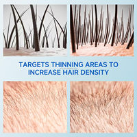 Huile de croissance des cheveux naturelle 4 en 1, huile essentielle pour les soins des cheveux Batana, favorisant la croissance, améliorant la brillance, développant des cheveux sains