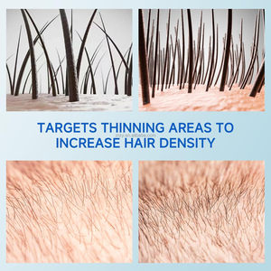 Huile de croissance des cheveux naturelle 4 en 1, huile essentielle pour les soins des cheveux Batana, favorisant la croissance, améliorant la brillance, développant des cheveux sains - Product Image 4