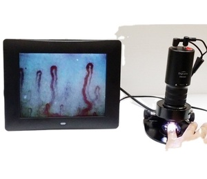 Microscope de microcirculation DMX980-1 Capillaroscope Nail Microskop - Product Image 1