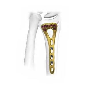 Plaque de fixation distale de fémur en acier inoxydable orthopédique pour implant chirurgical vétérinaire pour la fixation des fractures osseuses chez le chien et le chat - Product Image 5