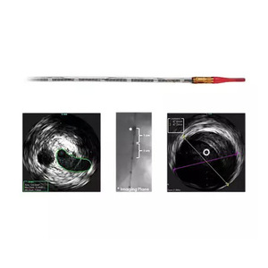 Catéter Avanzado de Grado Industrial VOLCANO VISIONS PV .014P RX Digital IVUS de 150 cm para Procedimientos de Imagenología de Arterias Periféricas - Product Image 2