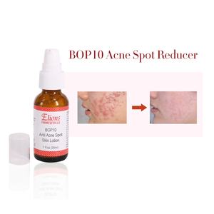 Corrector de Puntos Negros y Acné, Loción Aclarante con Azufre, Calmante, Hidratante y Antiacné para Rostro y Cuerpo - Product Image 2